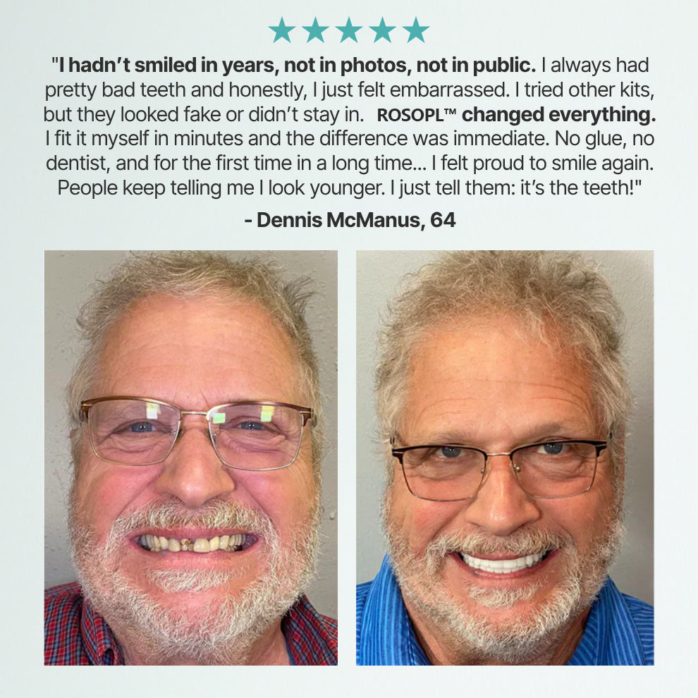 Ends Today: 75% OFF! ⏰Pryxo™ Medical Full Denture with Strong Suctiond Custom-Fit Full Functional Dentures🦷Obtain American Dental Association (ADA) Certification