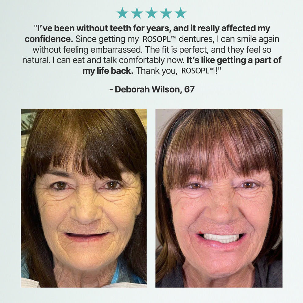 Ends Today: 75% OFF! ⏰Pryxo™ Medical Full Denture with Strong Suctiond Custom-Fit Full Functional Dentures🦷Obtain American Dental Association (ADA) Certification